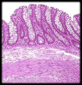 Colon of large intestine with simple columnar epithelium lining lumen. Note the numerous goblet cells that secrete mucus.