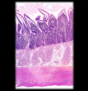 Duodenum of small intestine with villi and simple columnar epithelium on edge of villi