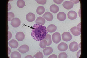 Basophil has dark purple granules and segmented nucleus