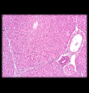 Liver illustrating lobule with central vein
