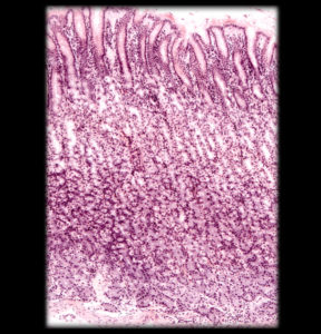 Stomach with simple columnar epithelium at inner border and numerous gastric glands and pits