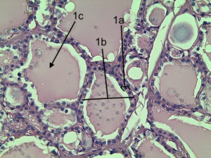 Thyroid gland has noncellular colloid within the follicle and each follicle is surrounded by simple cuboidal epithelium